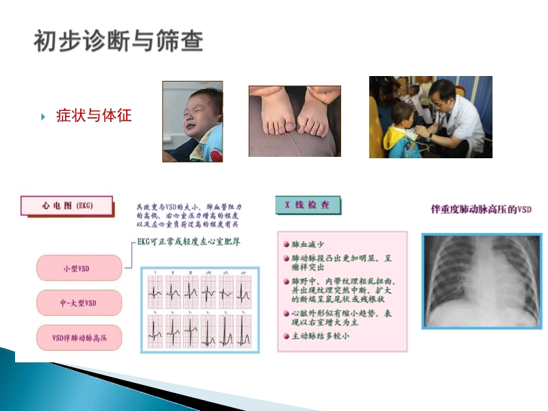 072815373246_02014-08-26先天性心脏病诊治现况_7.jpg