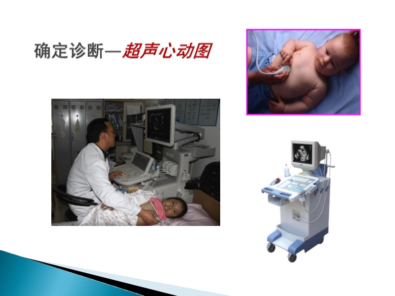 072815373246_02014-08-26先天性心脏病诊治现况_8.jpg