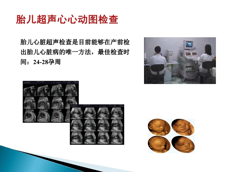 072815373246_02014-08-26先天性心脏病诊治现况_9.jpg