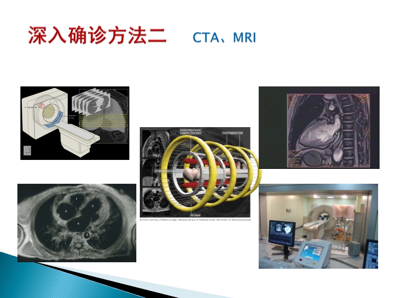 072815373246_02014-08-26先天性心脏病诊治现况_11.jpg