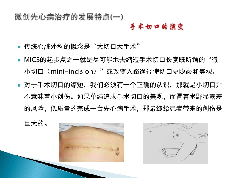 072815373246_02014-08-26先天性心脏病诊治现况_16.jpg