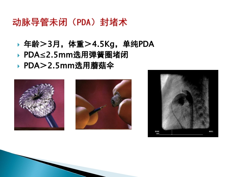 072815373246_02014-08-26先天性心脏病诊治现况_25.jpg