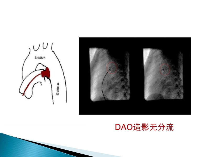 072815373246_02014-08-26先天性心脏病诊治现况_26.jpg