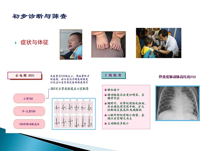 072815404699_02014-09-27当今诊治心血管疾病的热点问题_8.jpg