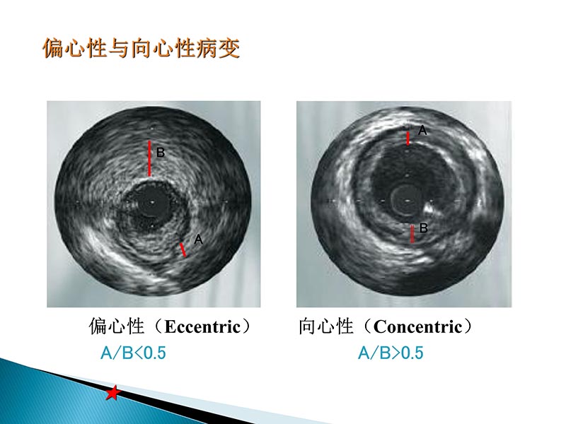 072815404699_02014-09-27当今诊治心血管疾病的热点问题_19.jpg
