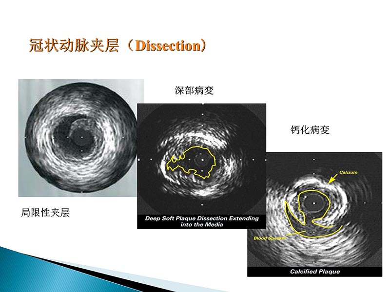 072815404699_02014-09-27当今诊治心血管疾病的热点问题_20.jpg