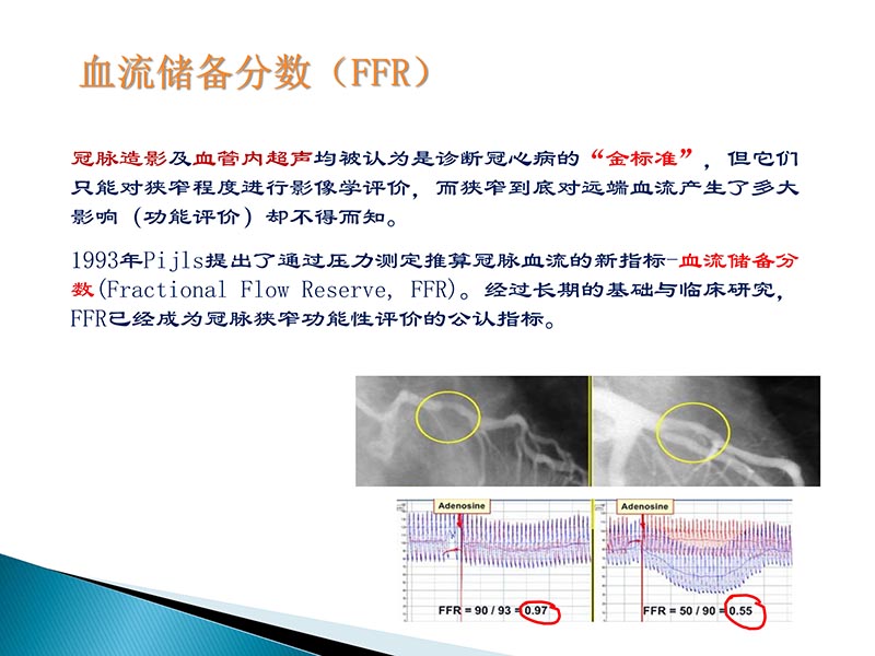 072815404699_02014-09-27当今诊治心血管疾病的热点问题_22.jpg
