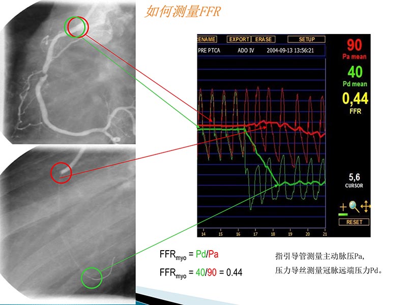 072815404699_02014-09-27当今诊治心血管疾病的热点问题_24.jpg