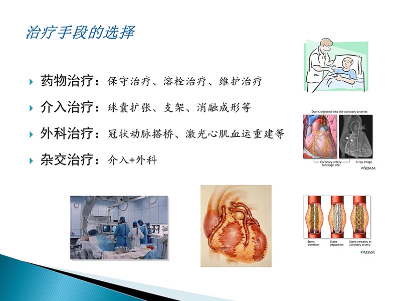 072815404699_02014-09-27当今诊治心血管疾病的热点问题_25.jpg