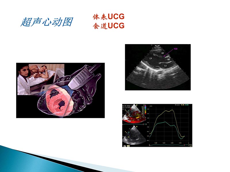 072815404699_02014-09-27当今诊治心血管疾病的热点问题_31.jpg