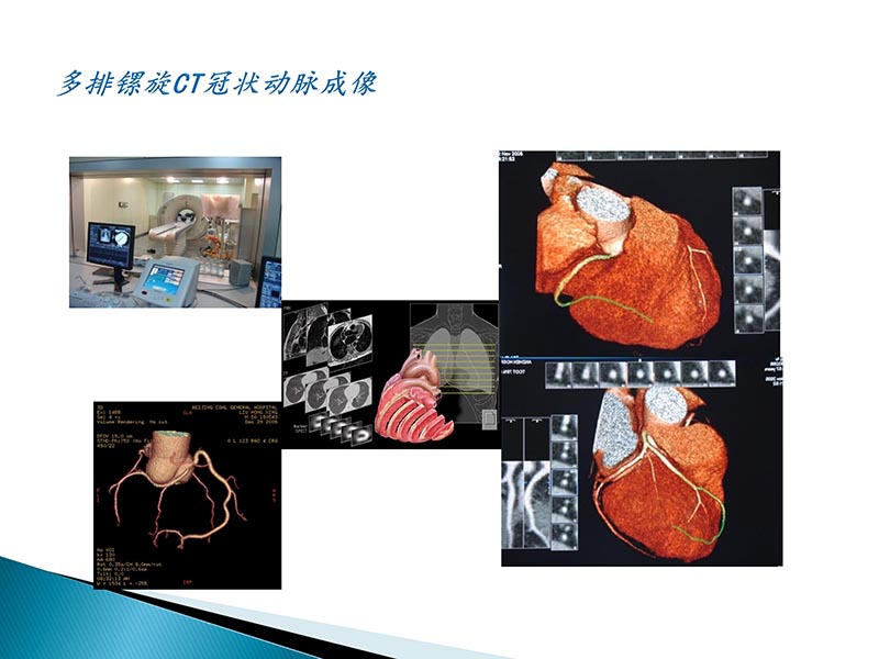 072815404699_02014-09-27当今诊治心血管疾病的热点问题_32.jpg