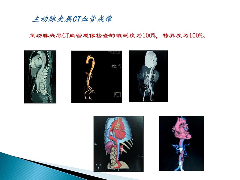 072815404699_02014-09-27当今诊治心血管疾病的热点问题_33.jpg