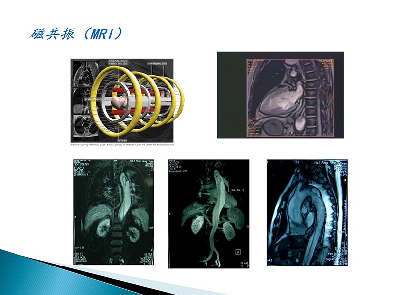 072815404699_02014-09-27当今诊治心血管疾病的热点问题_34.jpg
