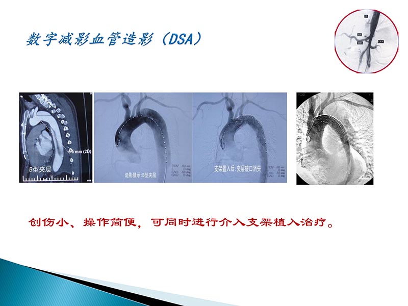072815404699_02014-09-27当今诊治心血管疾病的热点问题_37.jpg