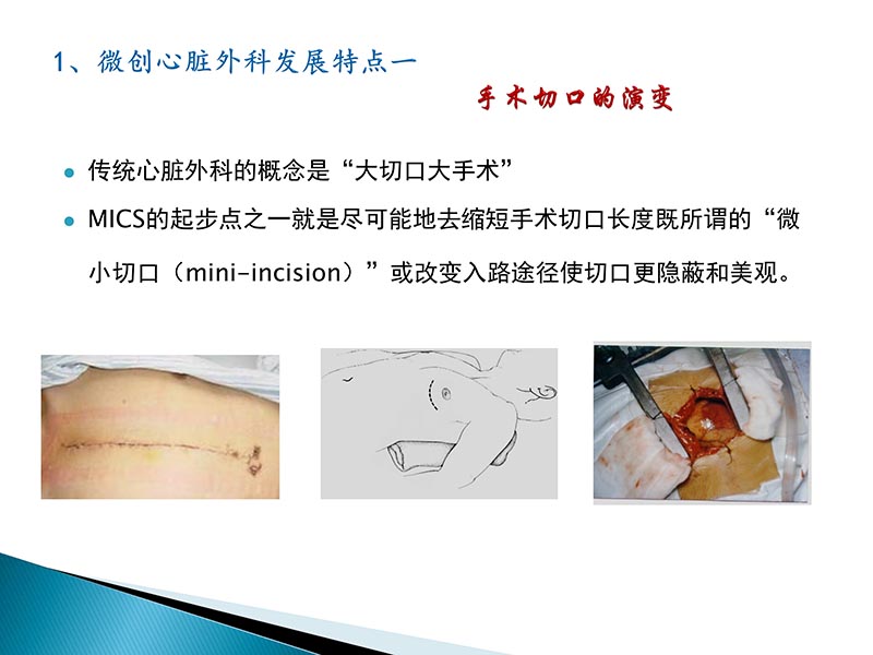 072815404699_02014-09-27当今诊治心血管疾病的热点问题_40.jpg