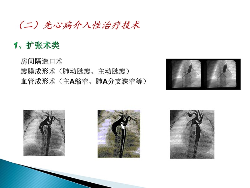 072815404699_02014-09-27当今诊治心血管疾病的热点问题_44.jpg