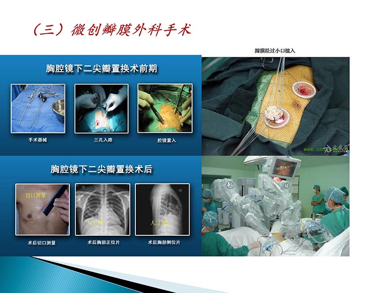 072815404699_02014-09-27当今诊治心血管疾病的热点问题_48.jpg