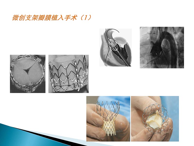 072815404699_02014-09-27当今诊治心血管疾病的热点问题_49.jpg