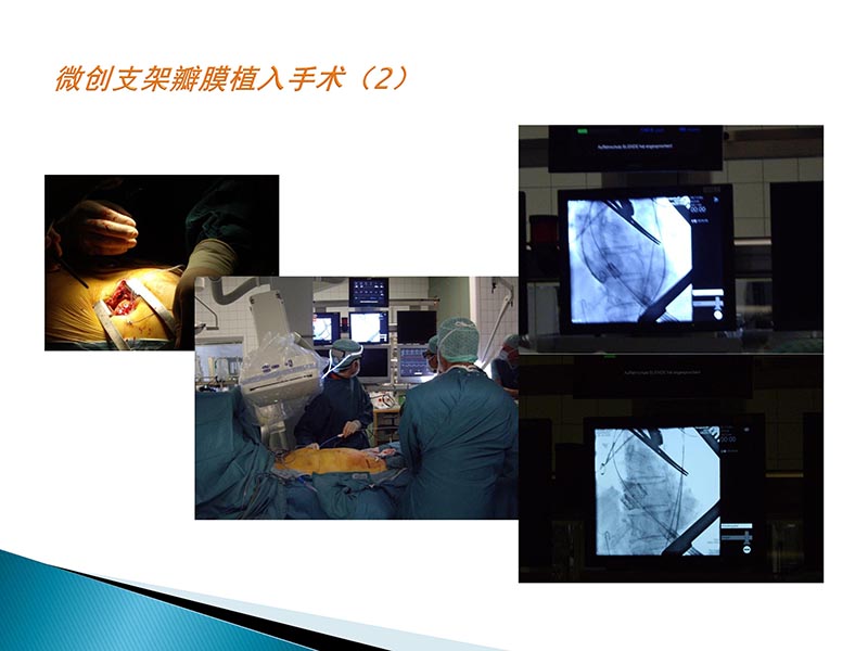 072815404699_02014-09-27当今诊治心血管疾病的热点问题_50.jpg