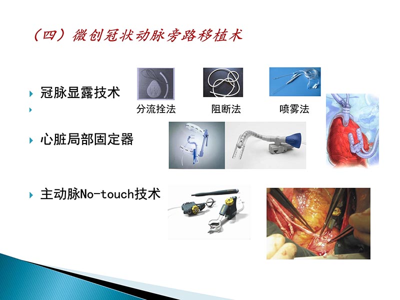 072815404699_02014-09-27当今诊治心血管疾病的热点问题_51.jpg