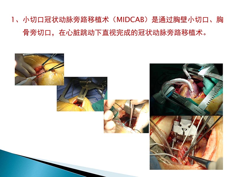 072815404699_02014-09-27当今诊治心血管疾病的热点问题_52.jpg