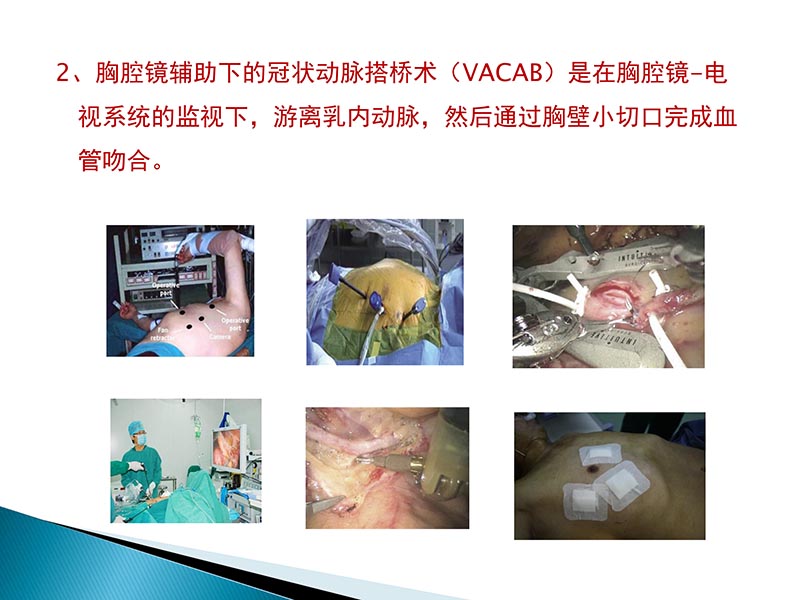 072815404699_02014-09-27当今诊治心血管疾病的热点问题_53.jpg