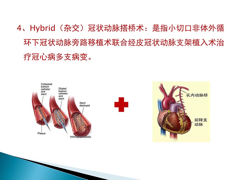 072815404699_02014-09-27当今诊治心血管疾病的热点问题_55.jpg
