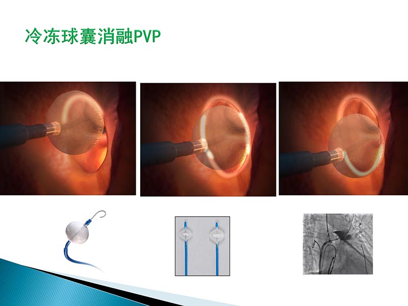 072815404699_02014-09-27当今诊治心血管疾病的热点问题_58.jpg
