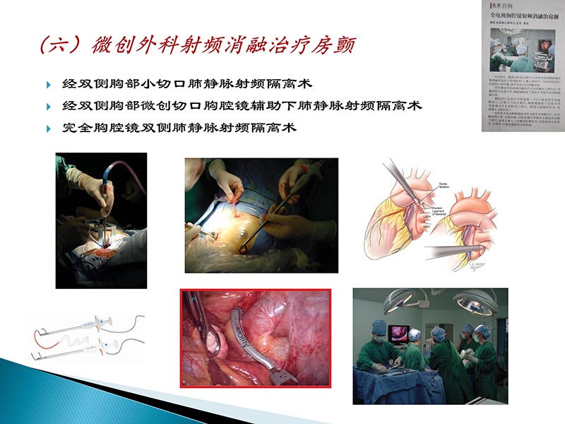 072815404699_02014-09-27当今诊治心血管疾病的热点问题_64.jpg