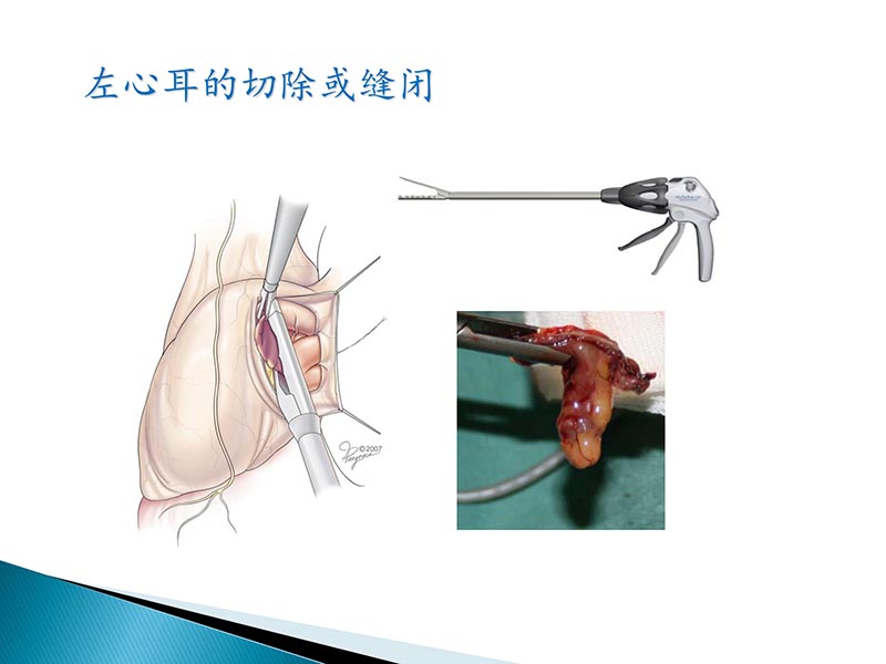 072815404699_02014-09-27当今诊治心血管疾病的热点问题_65.jpg