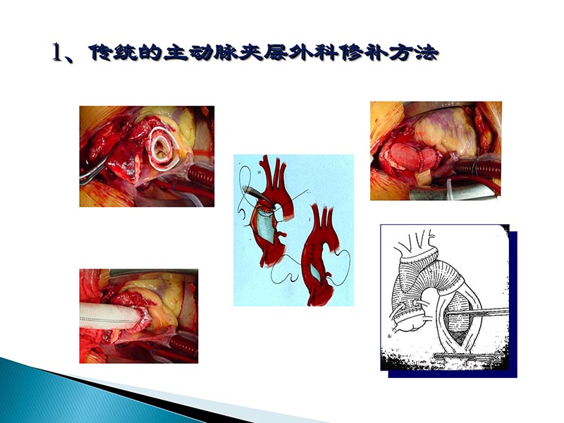 072815404699_02014-09-27当今诊治心血管疾病的热点问题_68.jpg