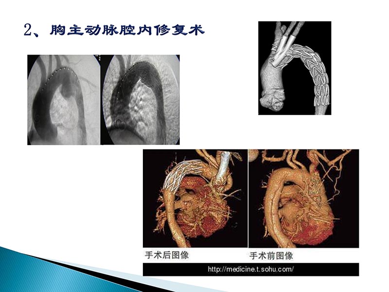 072815404699_02014-09-27当今诊治心血管疾病的热点问题_69.jpg
