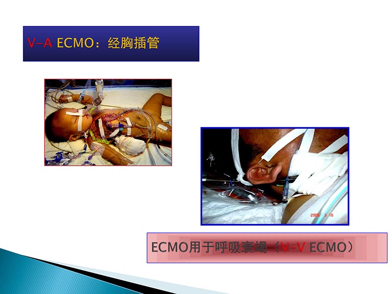 072815404699_02014-09-27当今诊治心血管疾病的热点问题_76.jpg