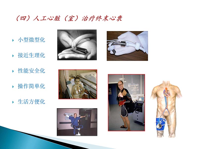 072815404699_02014-09-27当今诊治心血管疾病的热点问题_79.jpg
