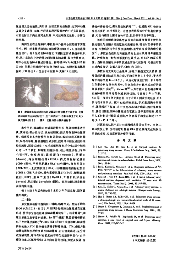 073115262202_015-原发性肺动脉肉瘤二例_2.jpg