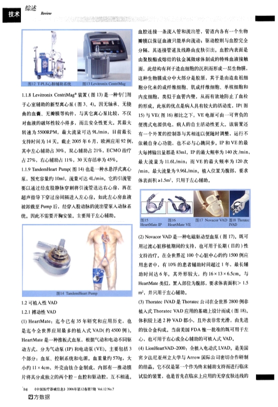 073116262916_028-当今人工心室辅助装置_3.jpg