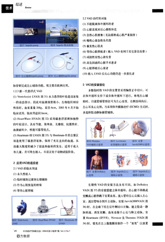 073116262916_028-当今人工心室辅助装置_5.jpg