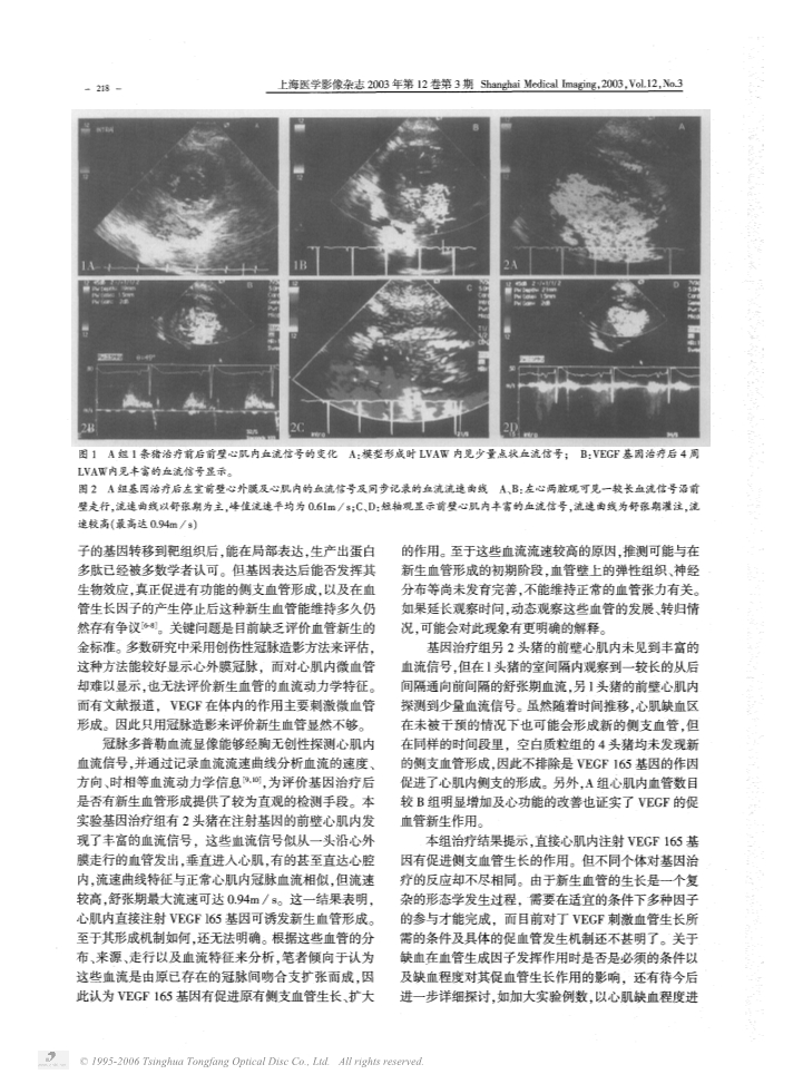 073117260924_043-冠脉多普勒血流显像评价血管内皮因子治疗慢性心肌缺血的实验研究_3.jpg
