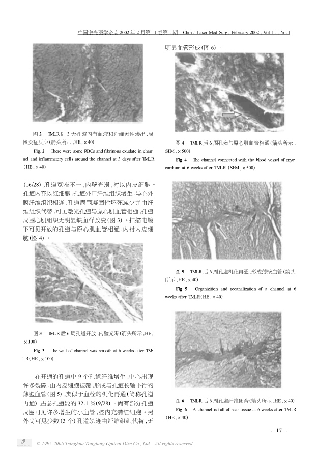 073117292999_048-激光心肌孔道损伤与修复的实验研究_3.jpg