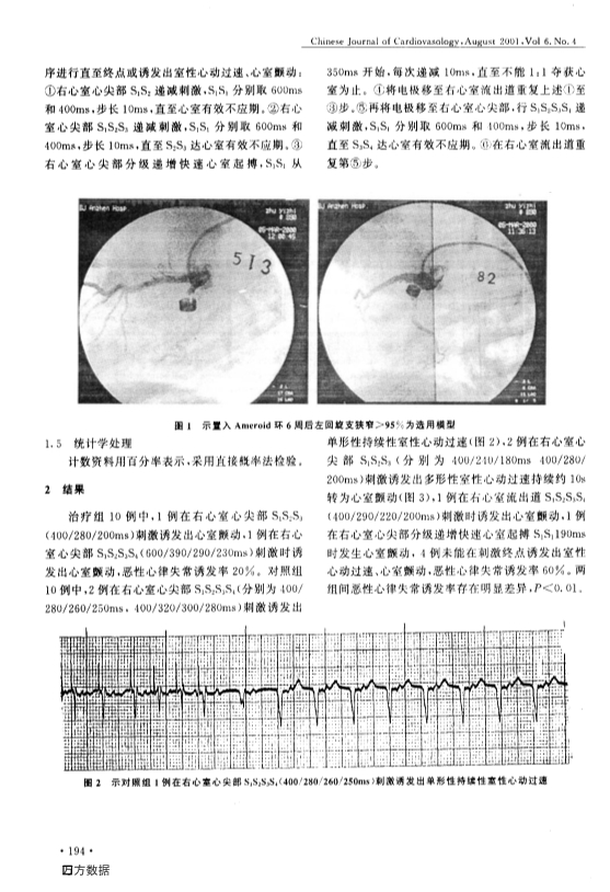 080114181454_059-猪慢性缺血心肌激光血运重建对电生理稳定性的影响_2.jpg