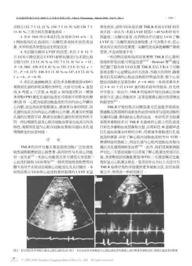 080121165287_064-超声心动图在激光心肌血运重建术前后的诊断价值及临床意义_3.jpg